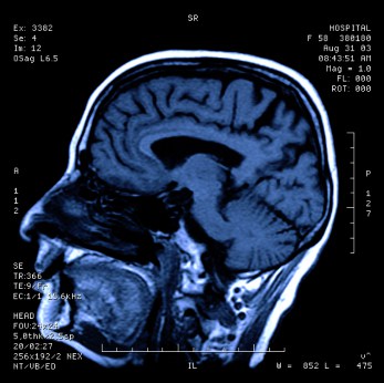 Looking inside our head provides answers for Internet business owners Looking inside our head provides answers for Internet business owners